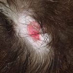 cat skin tag