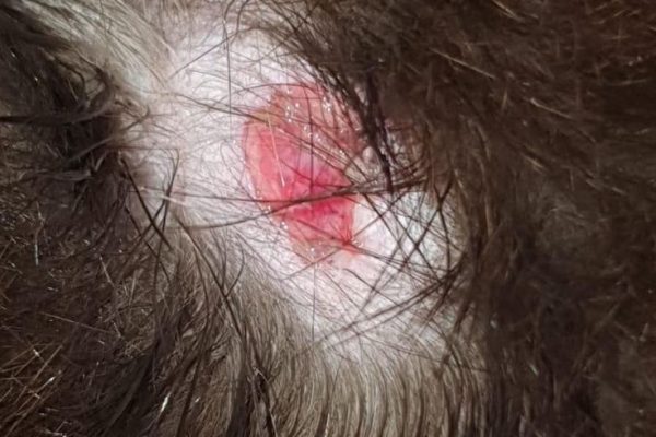 Cat Skin Tag: Are They Normal? Find Out the Facts Today cat skin tag
